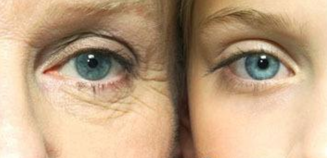 老年人皮膚老化的