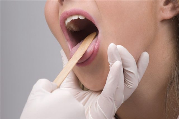 咽喉癌的早期症狀