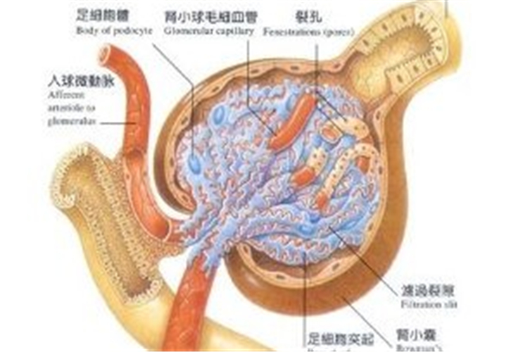 糖尿病腎病解說卡通
