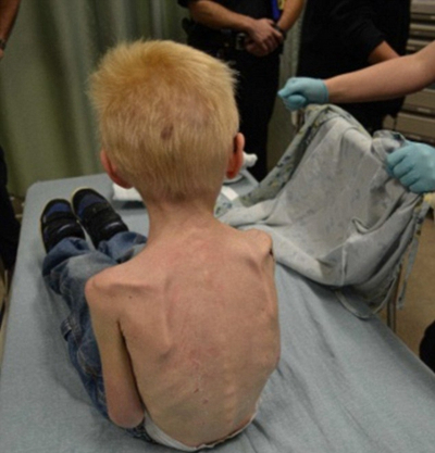 身體消瘦的原因 (74) 