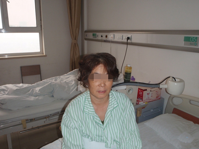 三叉神經痛治癒方法