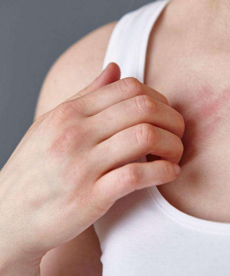 孕婦膽汁淤積症狀