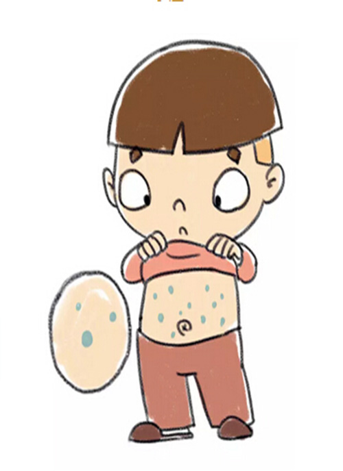 小兒腹部放射性皮炎 