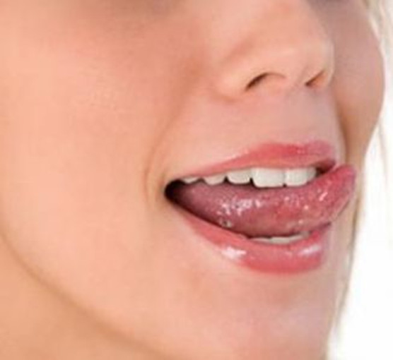 扁平苔蘚自愈了 