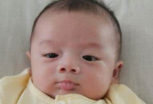 新生兒肺炎吐泡泡 (47) 