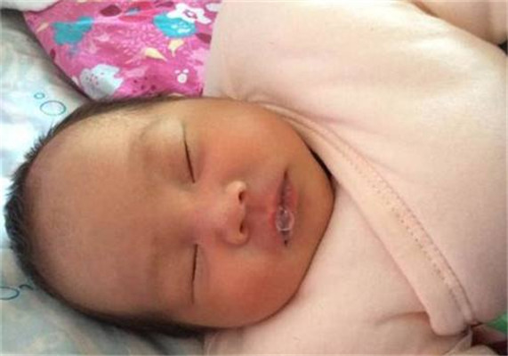 新生兒肺炎吐泡泡 (33) 