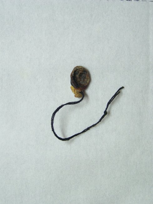 新生兒肚臍脫落圖 (8) 