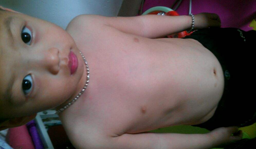 寶寶缺鈣雞胸圖 (54) 