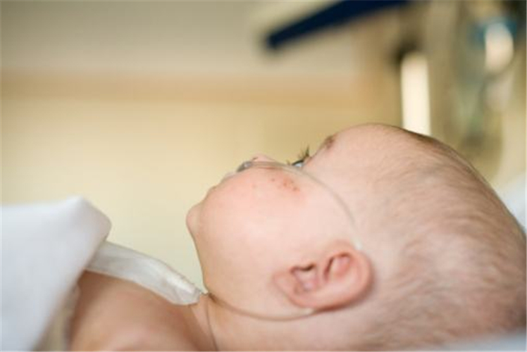 新生兒的先天性喉喘鳴