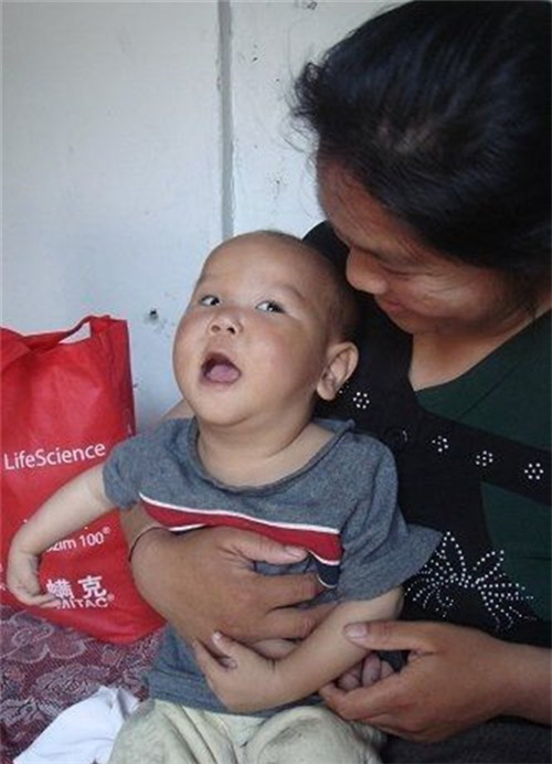 嬰幼兒先天性喉喘鳴