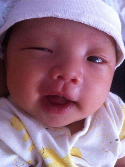 新生兒嘴唇發紫 (8) 