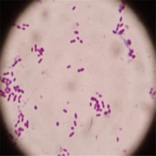 呼吸道感染細菌