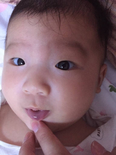新生兒嘴唇發紫 (46) 