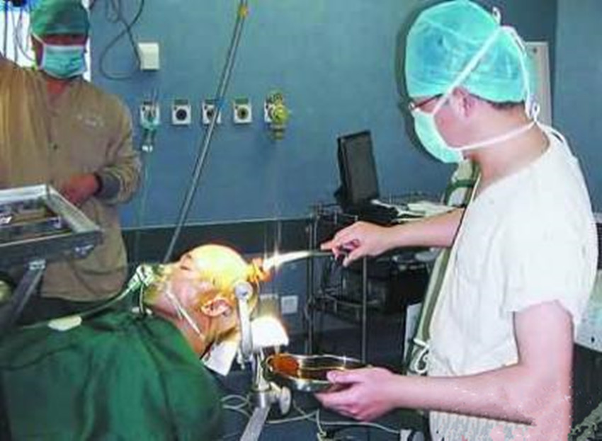 伽瑪刀治療腦膜瘤效果