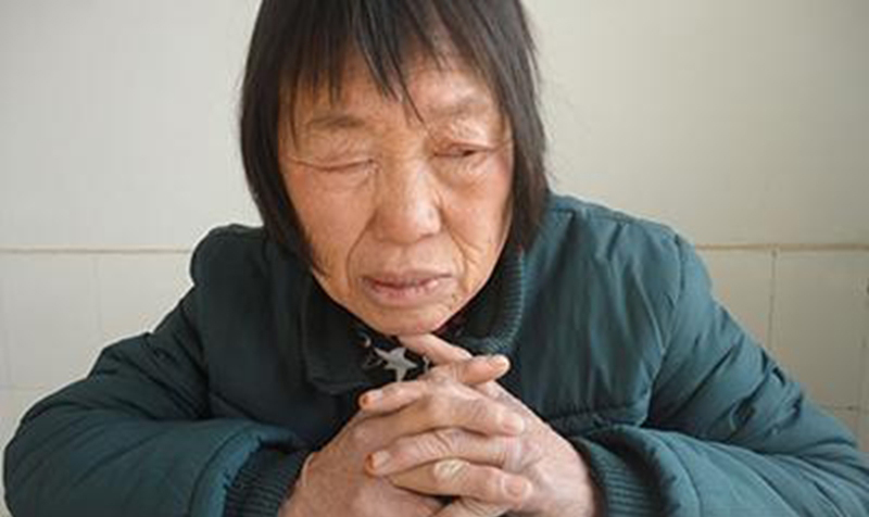 中老年婦女面肌痙攣