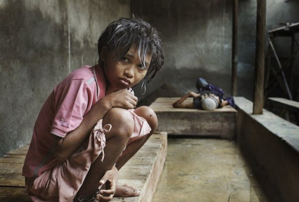 身體消瘦的原因 (83) 