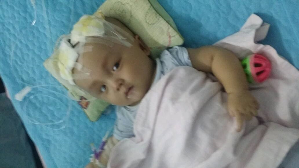 住院治療寶寶腦積水