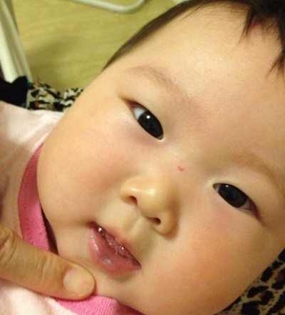 嬰兒嘴唇發紫 (39) 