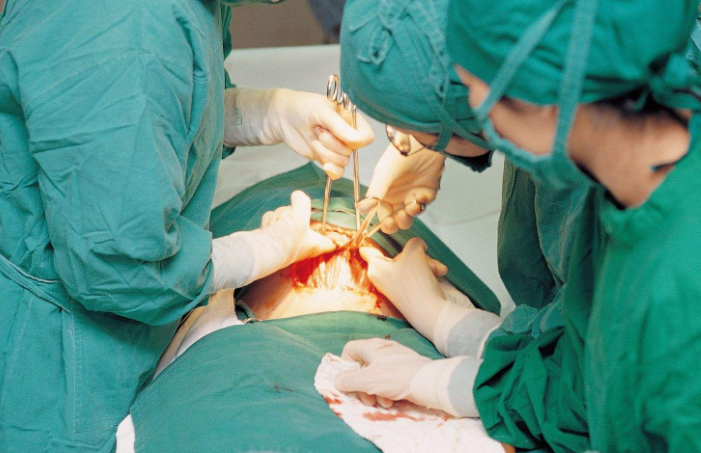 剖腹產手術 (55) 