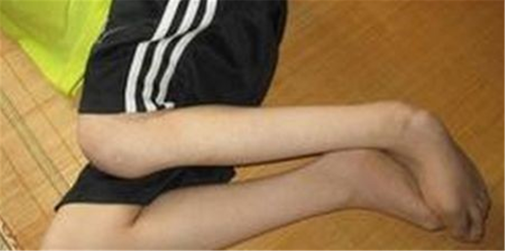 酒精中毒後遺症