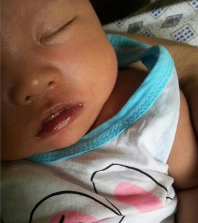 嬰兒嘴唇發紫 (43) 