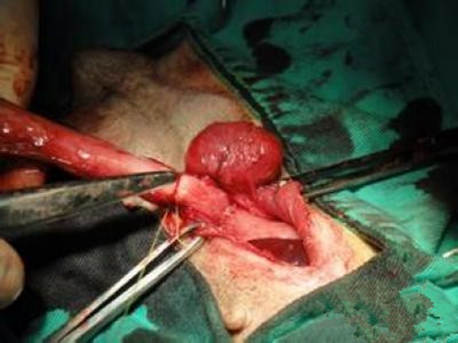 子宮脫垂三度手術咋做