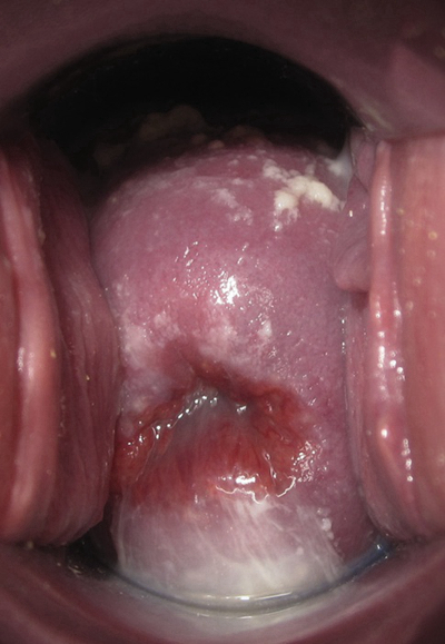 子宮肥大圖 (50) 