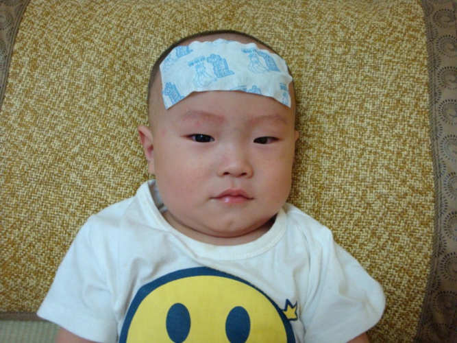 遭遇嬰兒急疹寶貝