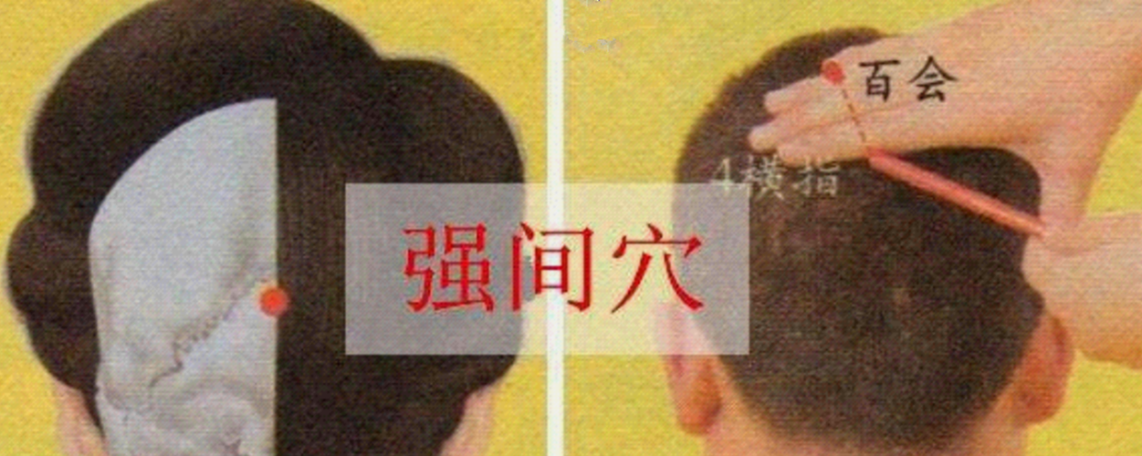 穴頭部穴位強間穴