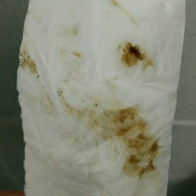 先兆流產分泌物