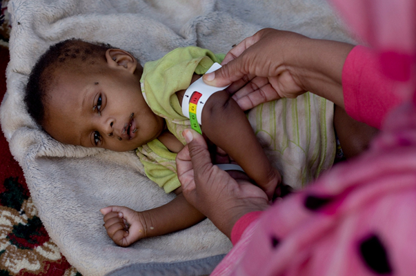 身體消瘦的原因 (65) 