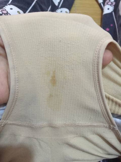 先兆流產分泌物