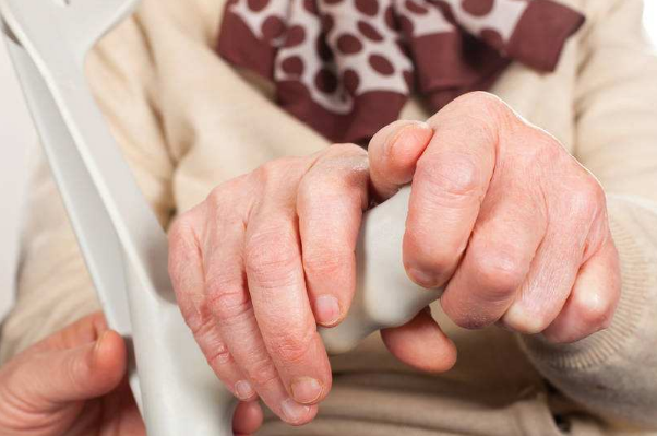 特發性震顫 (53) 