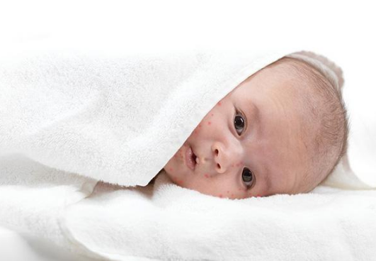 臉上皮膚過敏症狀