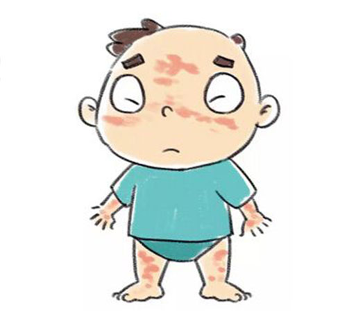 藥物性皮炎是什麼 