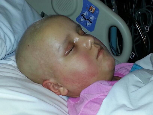 兒童白血病 (42) 