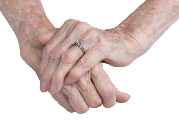 靜止性震顫 (55) 