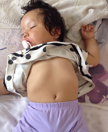 寶寶缺鈣雞胸圖 (52) 