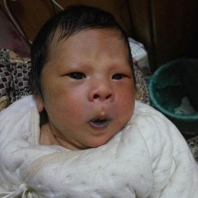 嬰兒嘴唇發紫 (50) 