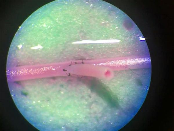 腦血管痙攣手術中
