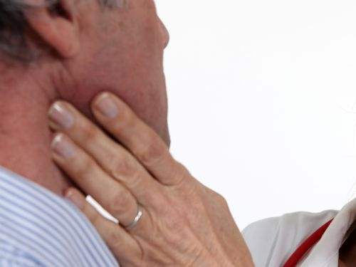 早期頸部淋巴癌