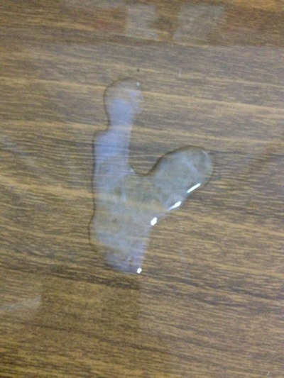 不正常精液液化