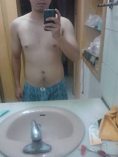 男生胸部突出 (34) 