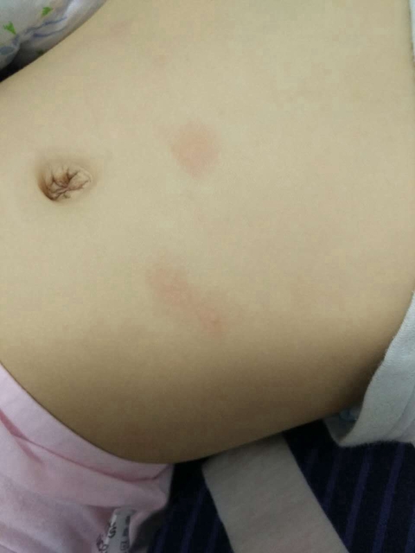 小兒流感症狀真實