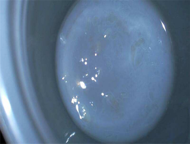 正常精子形態異常 