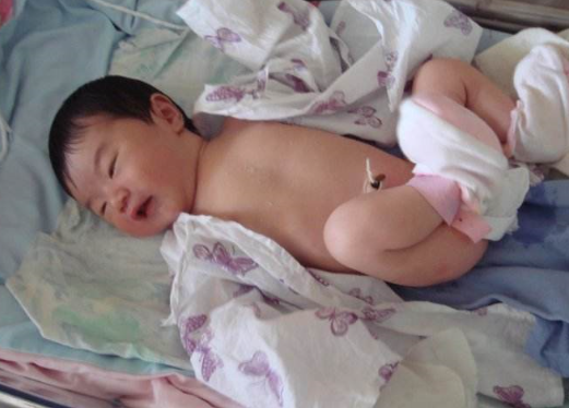 寶寶臍帶脫落後