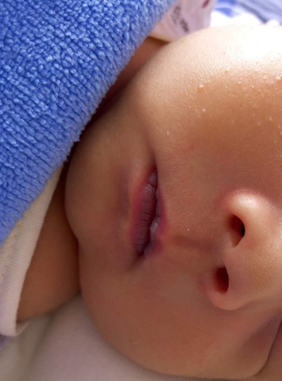 新生兒嘴唇發紫 (37) 