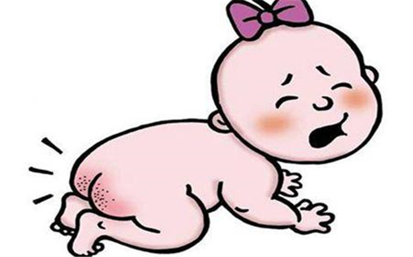 幼兒皮膚念珠菌病卡通