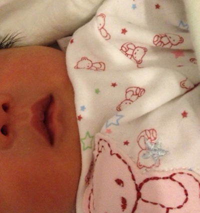 嬰兒嘴唇發紫 (38) 