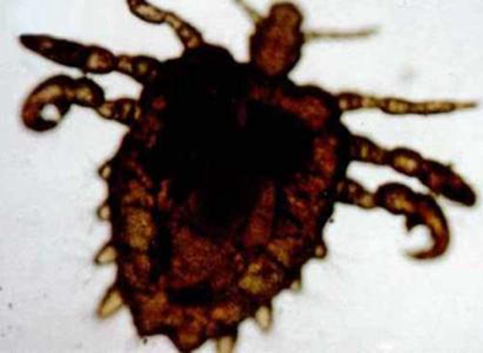 陰蝨用什麼藥可以根除